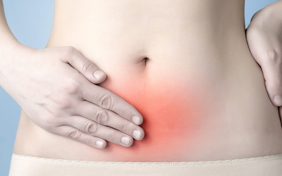 O Plano de Saúde e a Endometriose